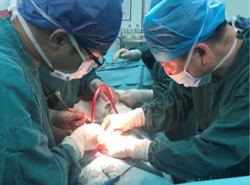 湖南省胸科医院外科主任王永利带领团队为胡丽成功实施手术。医院 供图