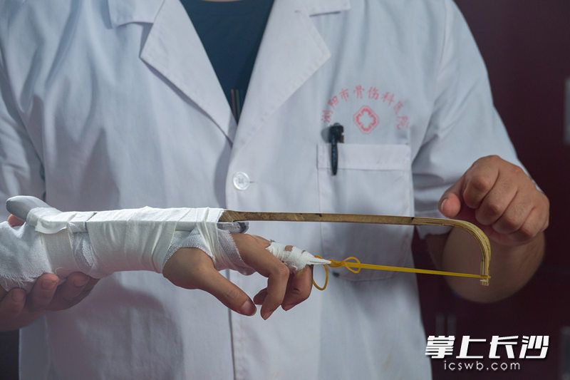 江林研发自制的竹弓牵引器械，已申请国家专利，对于手指骨折患者具有良好的康复锻炼的辅助作用。